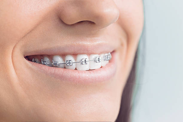 Best Teeth Whitening  in Mohave Valley, AZ
